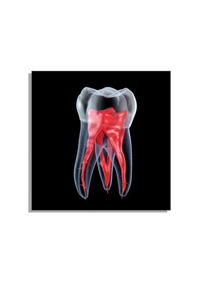 Kare Kanvas Duvar Tablosu Tekli Ağız Diş Sağlığı Dişçi Dental Kök Anatomisi Endodonti Çok Renkli