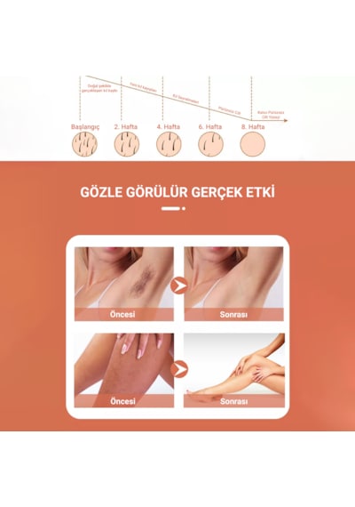 Veryfit PB1 5 Kademeli Buz Lazer Özellikli 999.900 Atımlı IPL Lazer Epilasyon Cihazı
