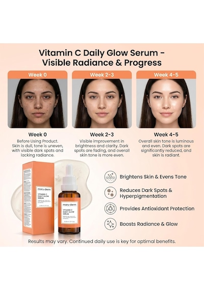 Maruderm C Vitamini Ve Peptit Aydınlatıcı Cilt Bakım Serumu Canlılık Ve Ton Eşitliği Görünümü Destekleyici Yüz Serumu,%10 Sodyum Askorbil Fosfat İle, 30 Ml