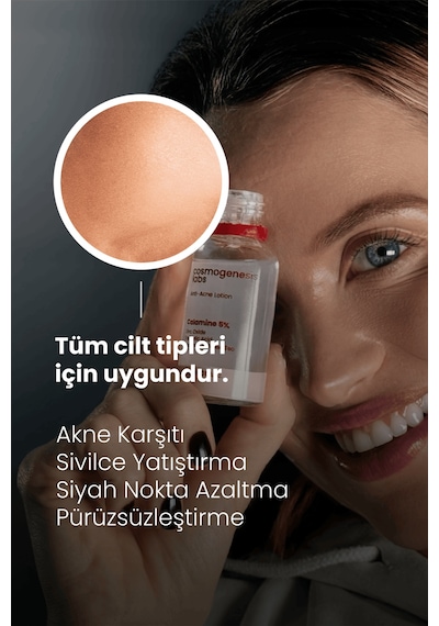 Cosmogenesis Labs Akne Önleyici Kurutucu Losyon 30ml – Yatıştırıcı Siyah Nokta Azaltıcı Vegan (%5 KALAMİN - YEŞİL ÇAY)