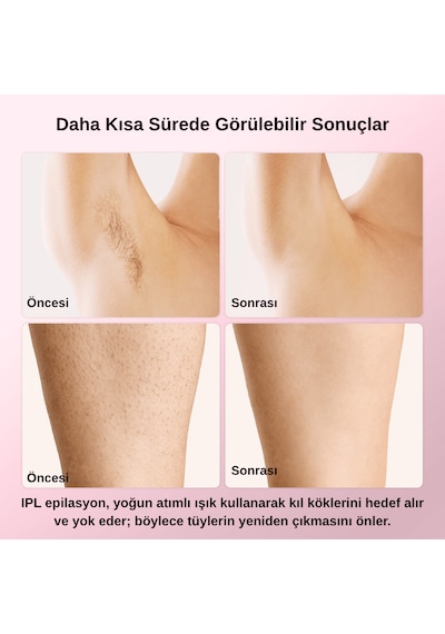 Pure Es T4 Taşınabilir Ipl Lazer Epilasyon Cihazı
