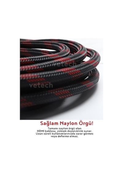 Vetech 1.5 Metre Hdmı Kablo Örgü Sargılı Dayanıklı Full Hd Televizyon/monitör/tv Hdmi Kablosu/uydu Alıcısı Uyumlu Hdmi Kablosu