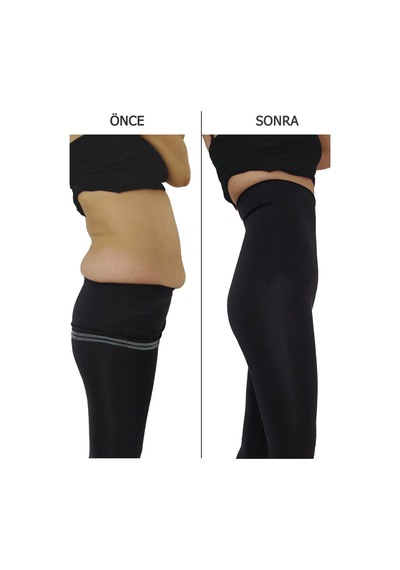 Young Fit Siyah Kadın Korse 2 Beden Yüksek Bel Korse Tayt Siyah