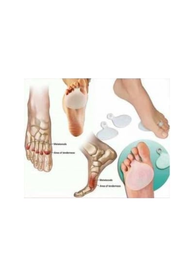Ayak Taban Ped Parmağa Geçmeli Silikon Metatarsal Pedi Yüzük Nası Standart