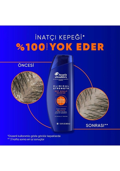 Head &amp Shoulders Clinical Strength Dry Scalp Rescue Kuru Saç Derisine Özel Şampuan 400 Ml Diğer
