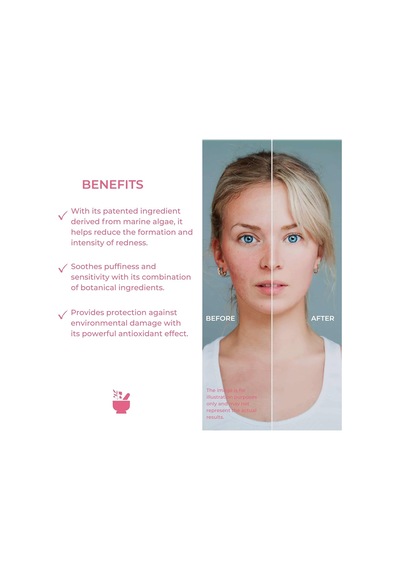 Cosmed Hassas Ciltler İçin Kızarıklık Karşıtı Onarıcı Krem 40 Ml