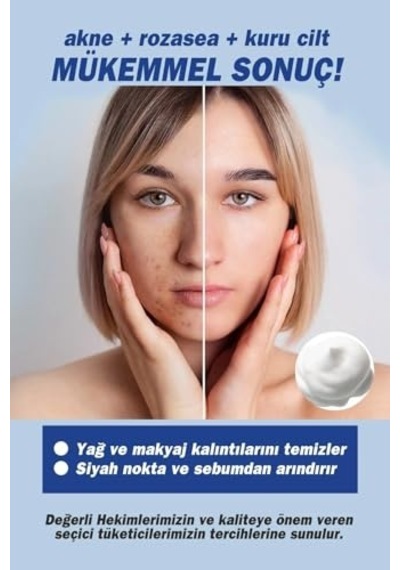 Thermal Aplikatörlü Yüz Temizleme Köpüğü 200 Ml