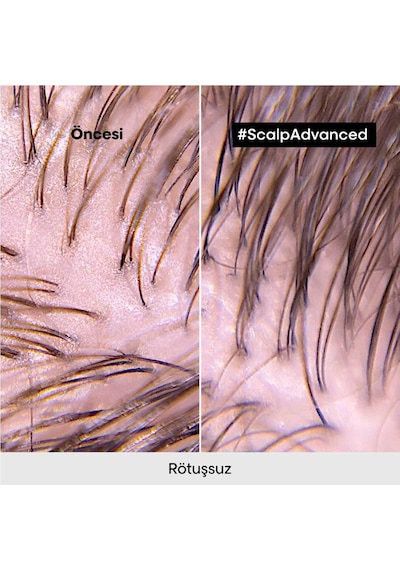 L'Oréal Professionnel Serie Expert Scalp Advanced Yağlanma Karşıtı Profesyonel Şampuan 500 ML