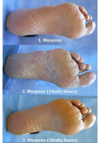 Beauty Foot Papatya ve Meyve Özlü Yenileyici Ayak Maskesi