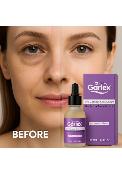 Garlex Göz Çevresi Bakım Serumu 30 ML