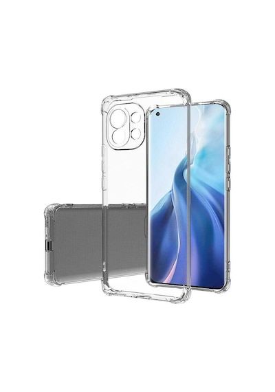 Xiaomi Mi 11 Lite Kılıf Nitro Anti Shock Darbe Emici Köşe Korumalı Şeffaf Silikon Kapak
