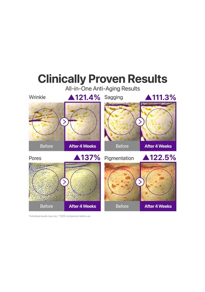 Tr No.9 Nad+ Retinal Volumetox Eye Cream, Anti-aging Treatment For Wrinkles, Fine Lines, Dark Circles & Dark Spots, Gent