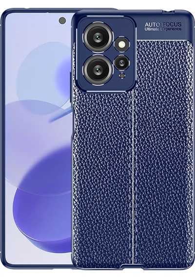 Xiaomi Redmi Note 12 4g Kılıf Zore Niss Deri Desenli Silikon Kılıf