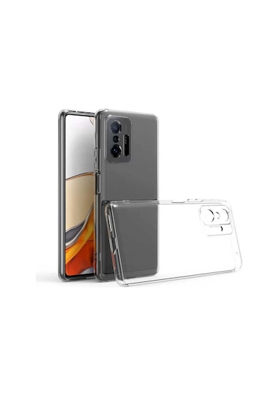 Bezos Mi 11t Pro Kılıf Lüx Şeffaf Silikon Ob
