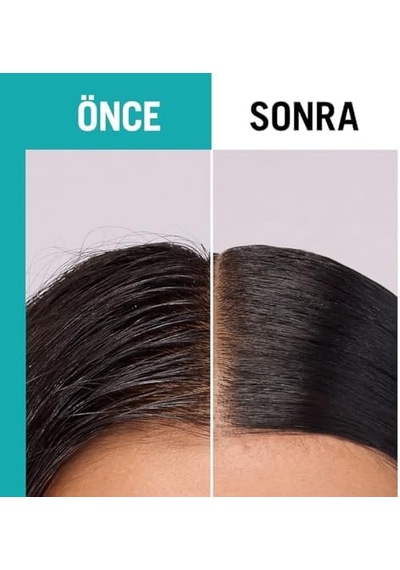 Scalp Balance Arındırıcı Serum 100 Ml
