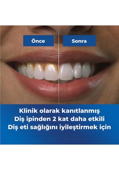 Waterpik Advanced Kablosuz Ağız Duşu