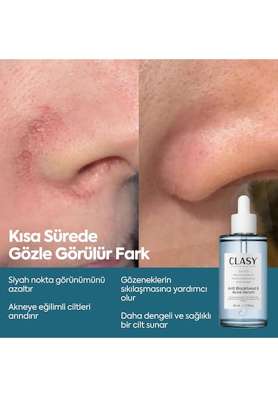 Niacinamide Yüz Serumu Gözenek Görünümünü Sıkılaştırmaya Ve Yağ Dengesini Desteklemeye Yardım