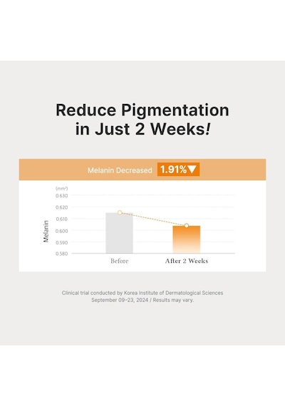 Vitamin C Boosting Serum Tüm Cilt Tipleri İçin Traneksamik Asit İçeren Günlük Yüz Serumu Koyu Lekelerin Ve Düzensiz Cilt Tonlarının Giderilmesine Yardımcı Olur, 30 Ml
