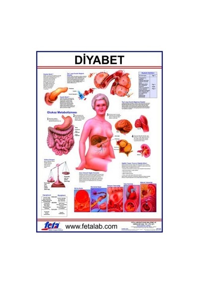 DİYABET LEVHASI