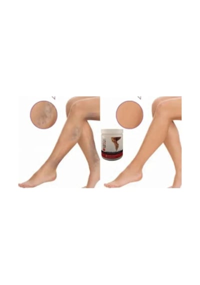 Süper Kremi 200ml / Varison Cream 200ml X 3 Adet