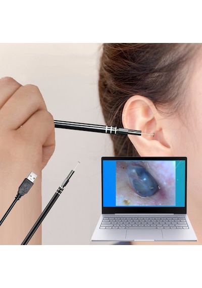 Kulak Temizleme Aracı Kaşık Hd Kamera Aracı Usb Tipi C Soket Win