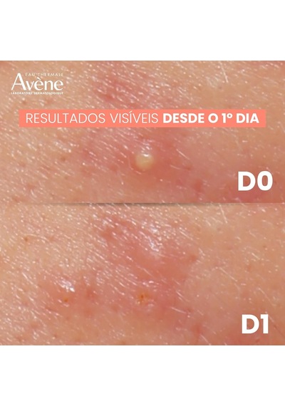 Eau Thermale Avene Cleanance Cilt Kusurları Karşıtı Yoğun Etkili Peeling Krem 40 Ml