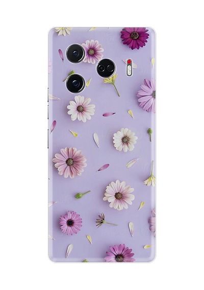 Camon 30 Pro 5g Kılıf Hd Baskılı Yüksek Korumalı Xt-camon30pro 2609 Stk-11-30pro