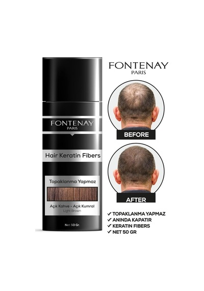 Saç Dolgunlaştırıcı Keratin Fibers Açık Kahve Topik Saç Tozu 50gr + Saç Spreyi 400ml 2'li S Renkli