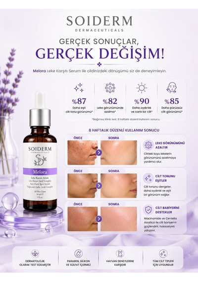 Soiderm Melora Leke Karşıtı Serum