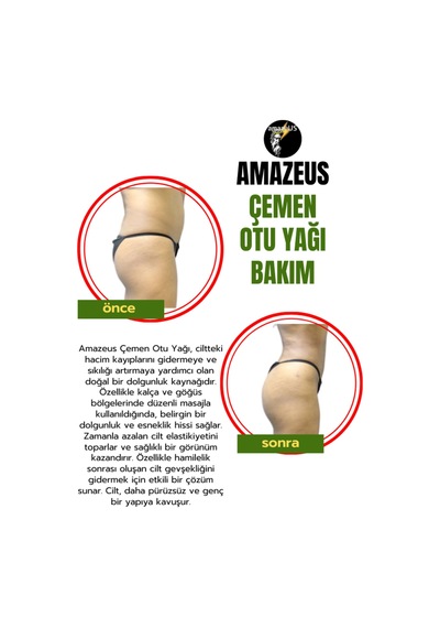 Amazeus Çemen Otu Yağı %100 Saf Ve Doğal Besleyici Etki 20 Ml / 0.7 Fl Oz