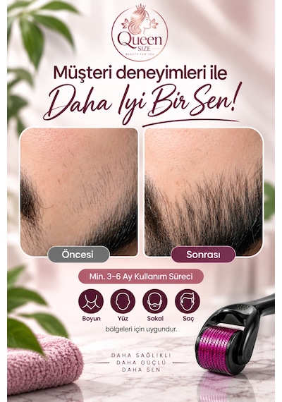 Queen Size Dermaroller 0.5 Mm 540 İğneli Cilt Bakım Rollerı Ve 30 Ml Cilt Bakım Spreyi 2 Li Set + Koruyucu Saklama Kutusu