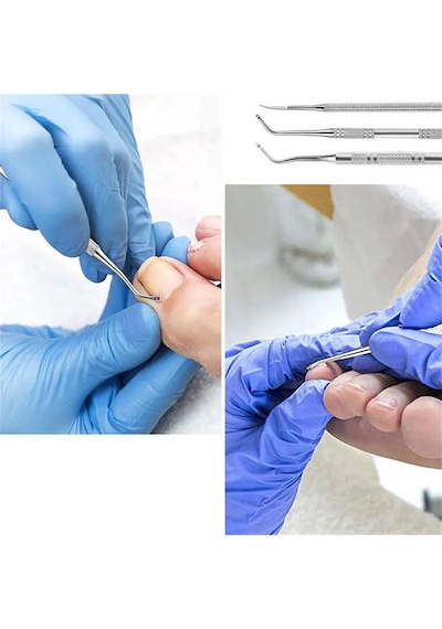 Batık Tırnak Çıkarıcı Set No:02