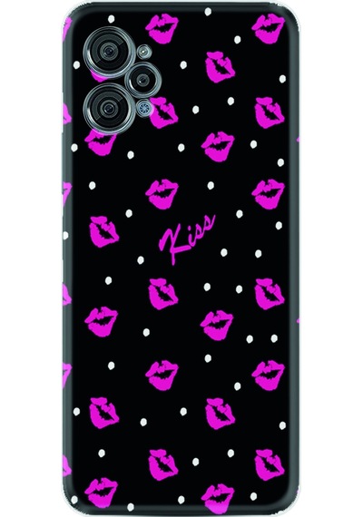 Casper Via X30 X30 Plus Kılıf Kılıf Desenli Silikon Kiss 1392