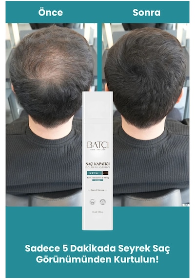 Saç Kapatıcı Dolgunlaştırıcı Sıvı Krem 50 Ml 10 Adet 1 Adet Tarak Hediyeli