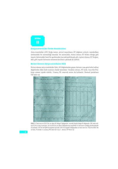 Normal Ve Patolojik Pediatrik Ekg Atlası
