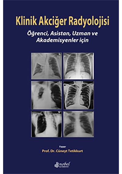 Klinik Akciğer Radyolojisi - Prof.Dr. Cüneyt Tetikkurt - Nobel Tıp Kitabevleri