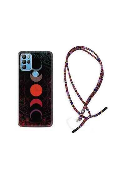General Mobile Gm21 Pro Kılıf Rasta Boyun Askılı Epiclys 1645