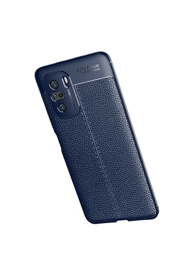 Xiaomi Mi 11I Kılıf Zore Niss Deri Desenli Silikon Kılıf