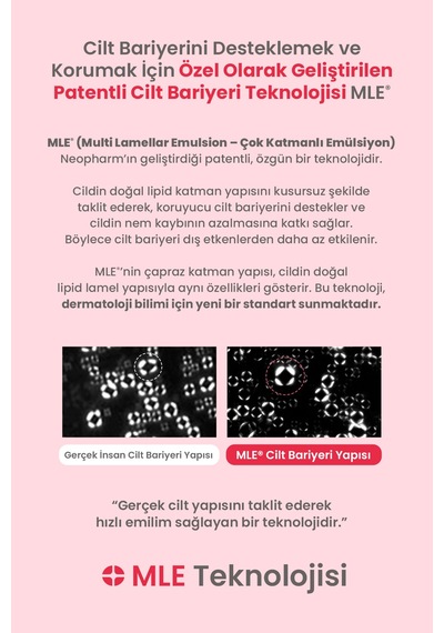 Bebeklere&yenidoğanlara Özel Göz Yakmayan Konak&sebum Karşıtı Şampuan Atopalm Newborn Scalp Shampoo