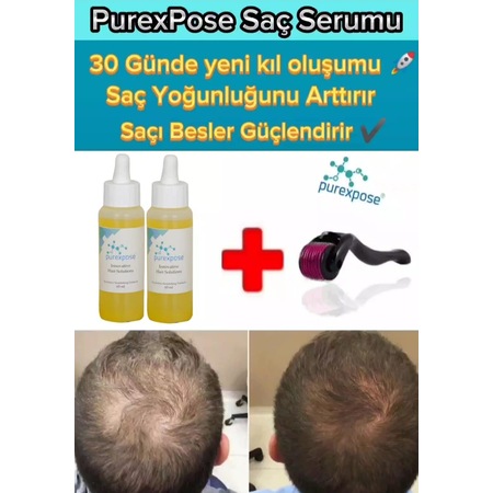 Purexpose Sarı Saç Bakım Serumu 2 x 60 ML + Dermaroller