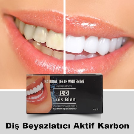Beyaz dişler beyazlatma sistemi - yorumlar, kullanım talimatları Beyaz dişler beyazlatma sistemi - yorumlar, kullanım talimatları