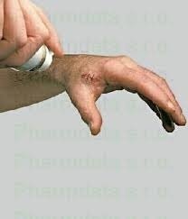 Opside Cilt Spreyi 75 Ml Fiyatlari Ve Ozellikleri