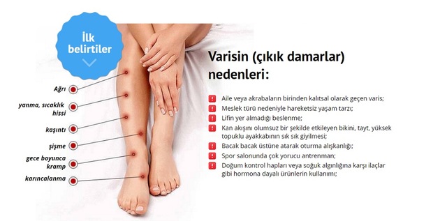 varis kremi orijinal urun varison fiyatlari ve ozellikleri