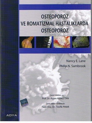 Osteoporoz Ve Romantizmal Hastalıklarda Osteoporoz