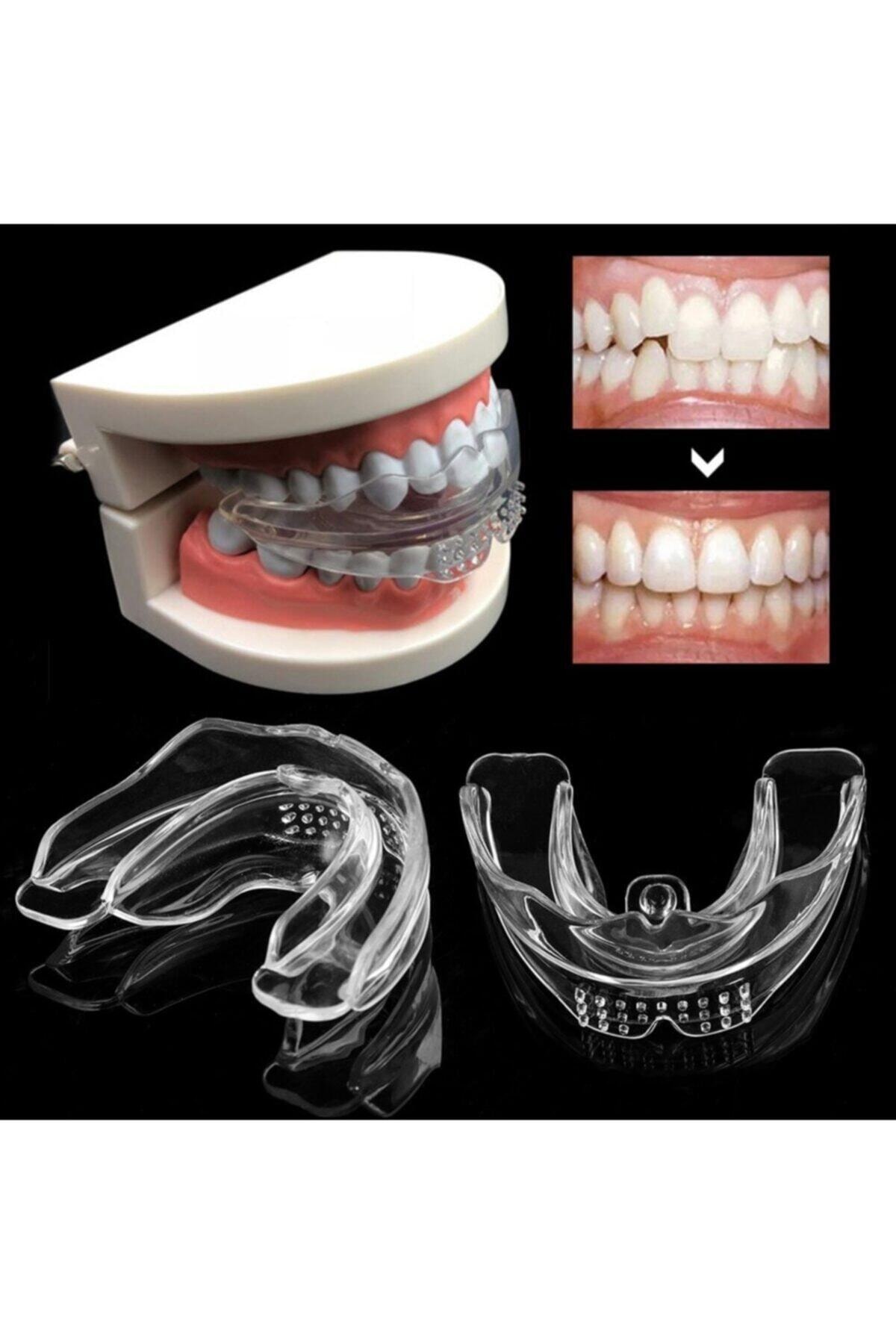Diş Silikon Ortodontik Parantez D1 Yumuşak D2 Orta D3 Sert